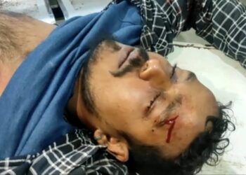 ব্রজপুরে বিজেপি সিপিএম সংঘর্ষে গুরুতর আহত ৫