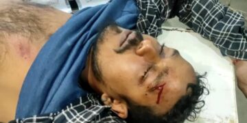 ব্রজপুরে বিজেপি সিপিএম  সংঘর্ষে গুরুতর আহত ৫