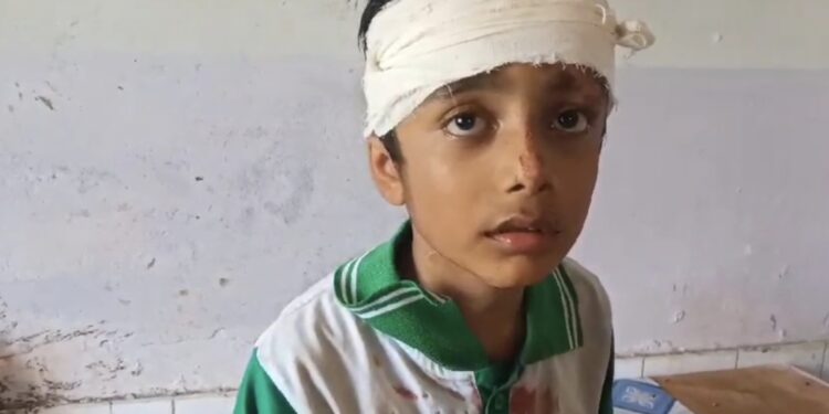 অটোর ধাক্কায় গুরতর আহত প্রথম শ্রেণীর এক ছাত্র