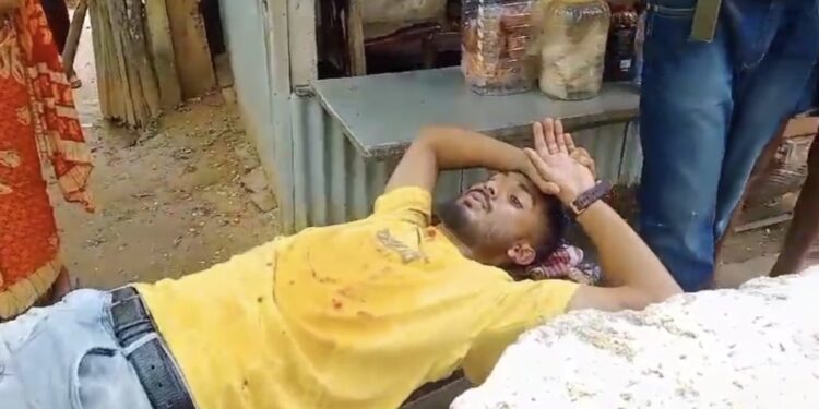 বাসের ধাক্কায় গুরুতর আহত এক স্কুটি চালক