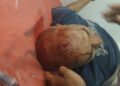রাস্তা বন্ধ করে দেওয়ার বিবাদকে কেন্দ্র করে দুই পক্ষের সংঘর্ষে গুরুতর আহত এক