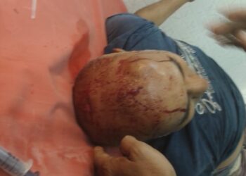 রাস্তা বন্ধ করে দেওয়ার বিবাদকে কেন্দ্র করে দুই পক্ষের সংঘর্ষে গুরুতর আহত এক