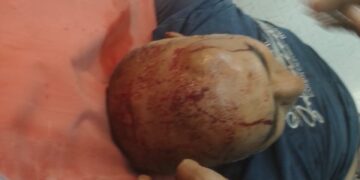 রাস্তা বন্ধ করে দেওয়ার বিবাদকে কেন্দ্র করে দুই পক্ষের সংঘর্ষে গুরুতর আহত এক