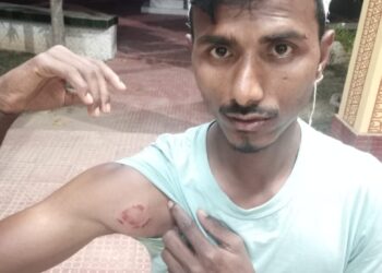 সামান্য বিষয়কে কেন্দ্র করে সঙ্গবদ্ধ আক্রমণে গুরুতর আহত দুই