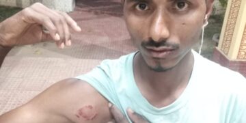 সামান্য বিষয়কে কেন্দ্র করে সঙ্গবদ্ধ আক্রমণে গুরুতর আহত দুই