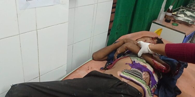 ভয়াবহ যান দুর্ঘটনায় রক্তাক্ত এক যুবক!